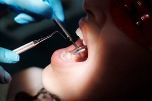 How Dental Associations Promote Oral Health in Communities