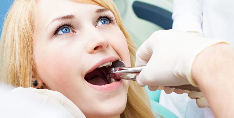 What to Expect During a Tooth Extraction: Step-by-Step Guide