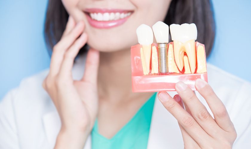Complete Guide to Dental Implants: Are They Right for You?