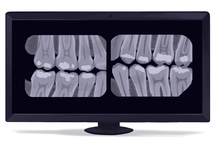Children and Dental X-rays: What Parents Need to Know.