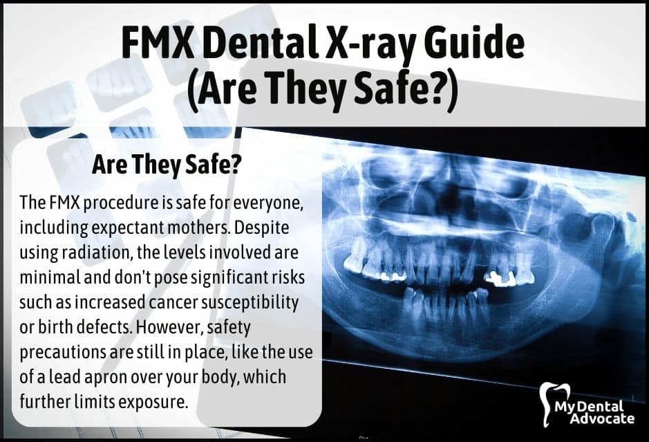 Dental X-rays: Types, Purpose, and Safety Concerns.
