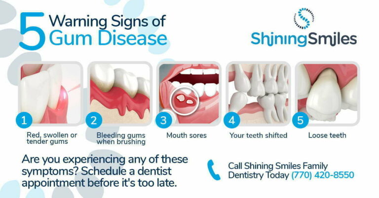 Early Detection and Prevention of Gum Disease