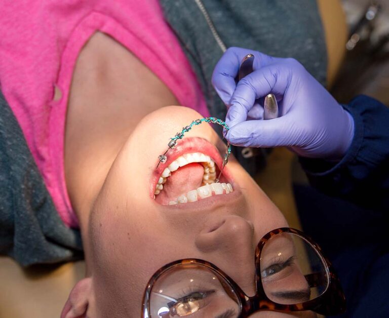 Orthodontic Care for All Ages: Breaking Down the Barriers
