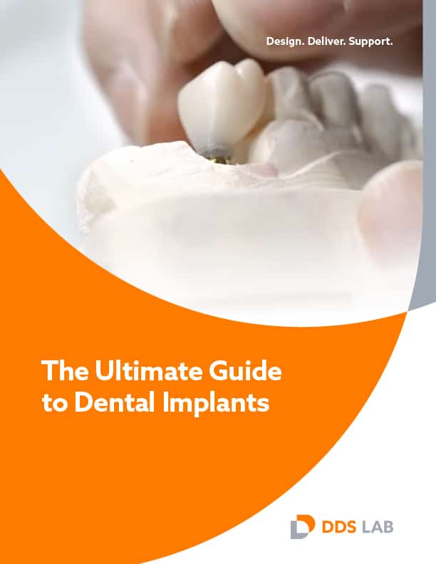 Are Dental Implants Right for You? A Comprehensive Guide