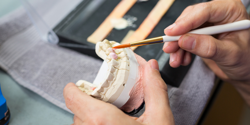 Porcelain Veneers: Benefits and What to Expect
