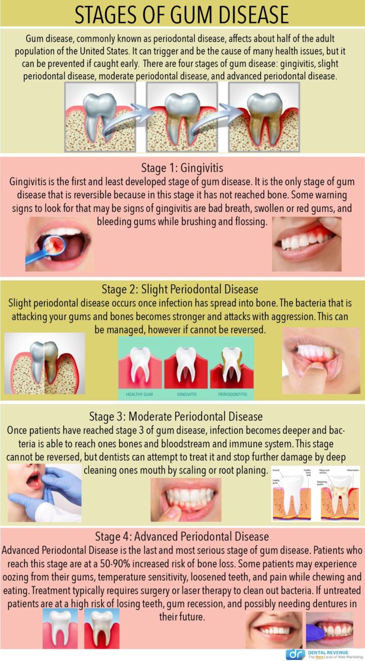 Bleeding Gums Post-Procedure: When to Seek Emergency Dental Care