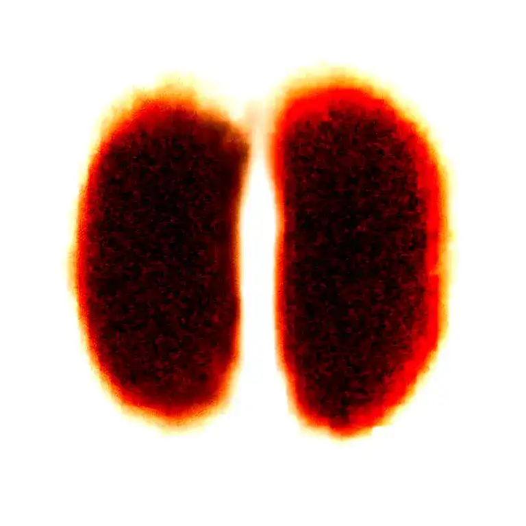 Two Rose Wrapped One Black One Red