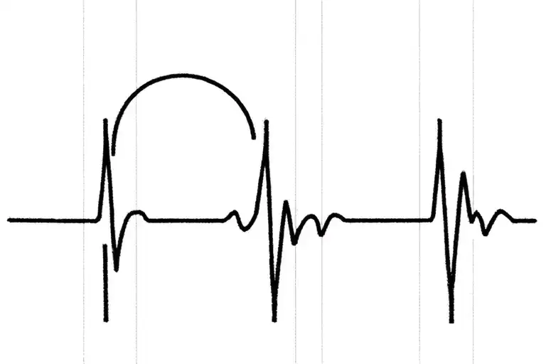 Heartbeat Line Forming Into C